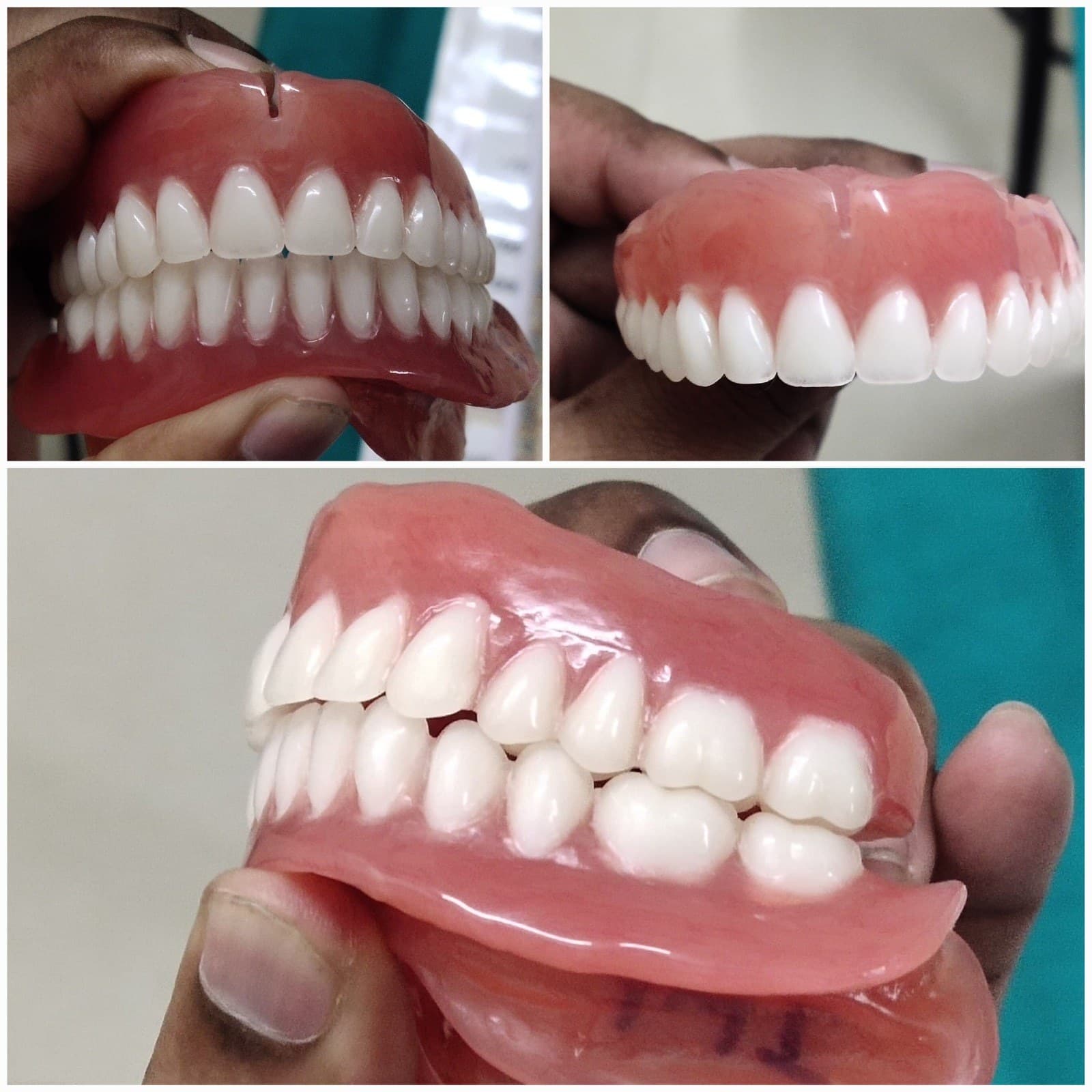 Complete denture